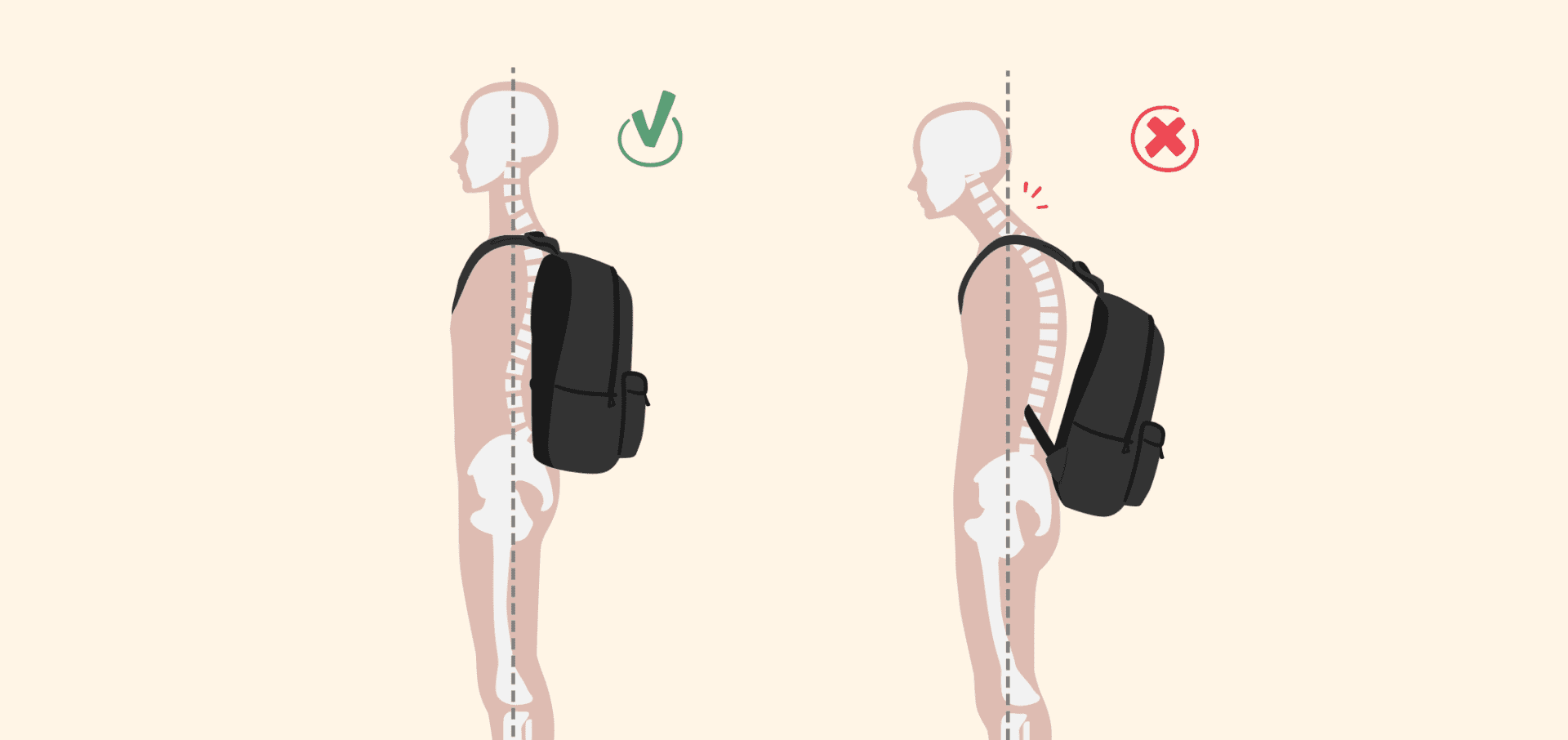 The Impact of Heavy School Bags on Your Child’s Posture - IRA Children ...