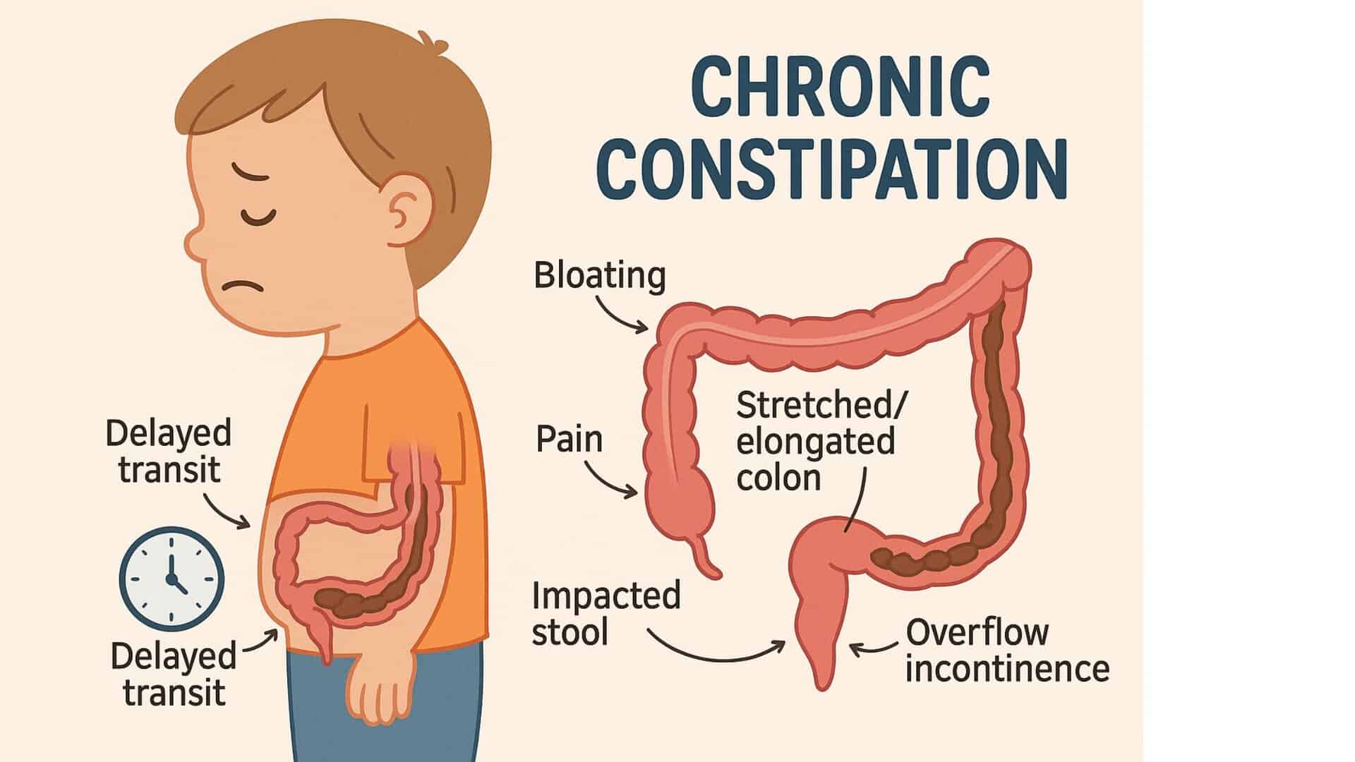 When Your Child Can’t Go: Understanding Constipation in Children - IRA ...