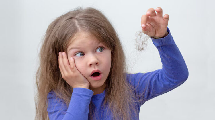 Hairfall In Children