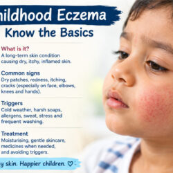 The Facts About Childhood Eczema: Managing Dry, Itchy Skin